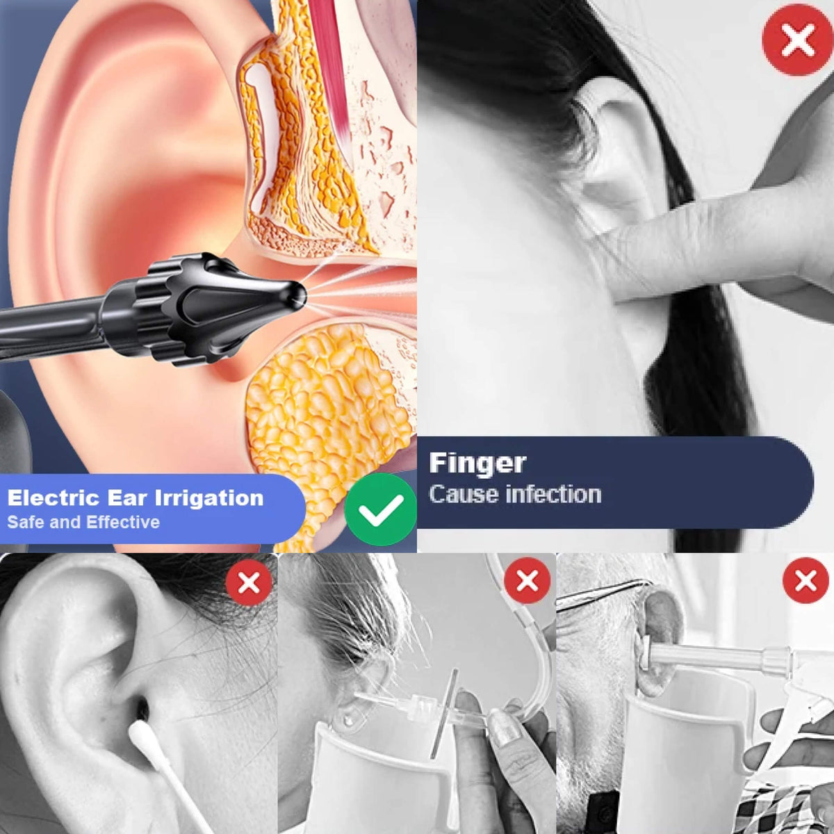 Ear Cleaner | Water-Rinse System, Multiple Tips & Rechargeable Design