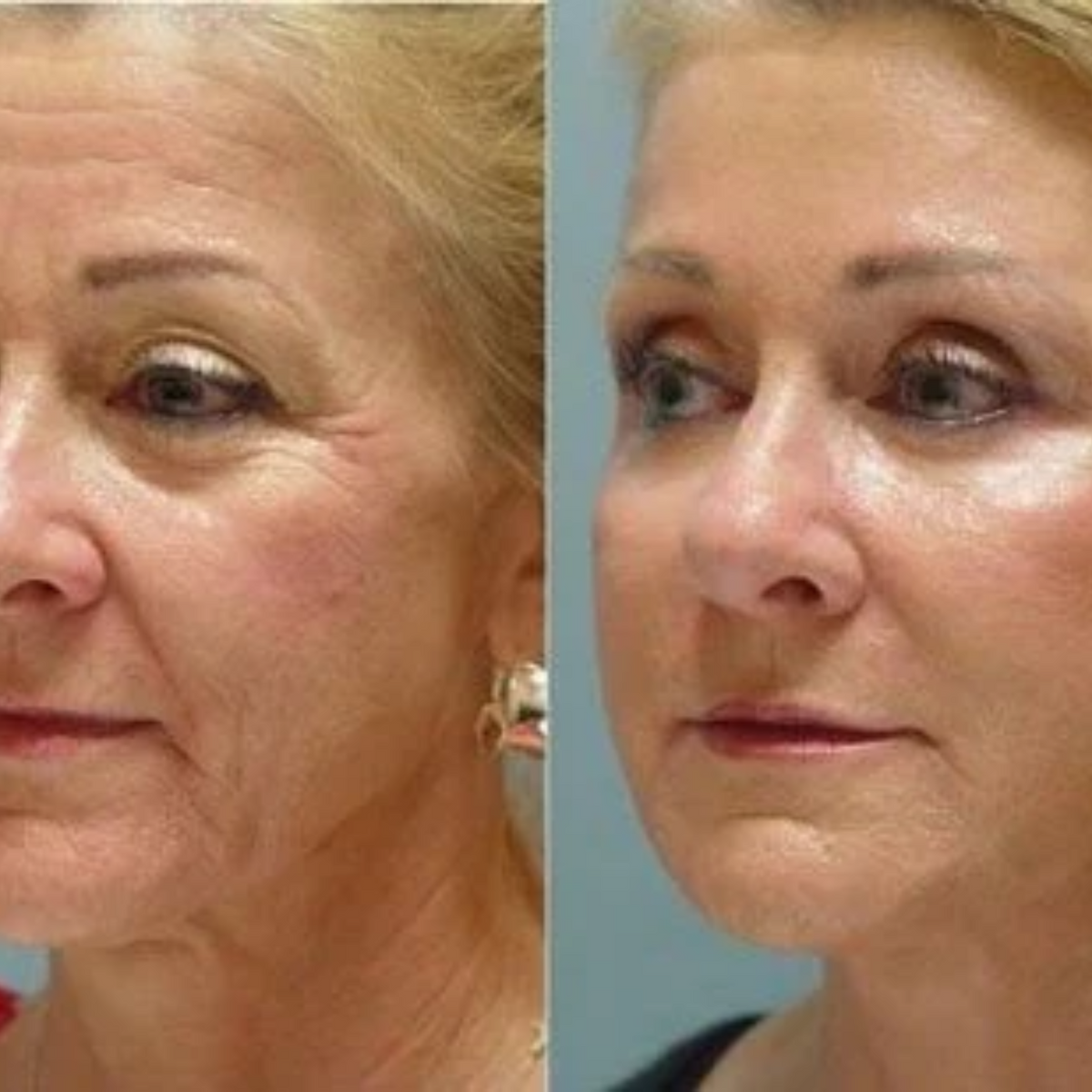 LED Light Therapy Mask with Neck Piece | 7 Colour Light Modes, Adjustable Intensity | Supports Clearer, Firmer-Looking Skin