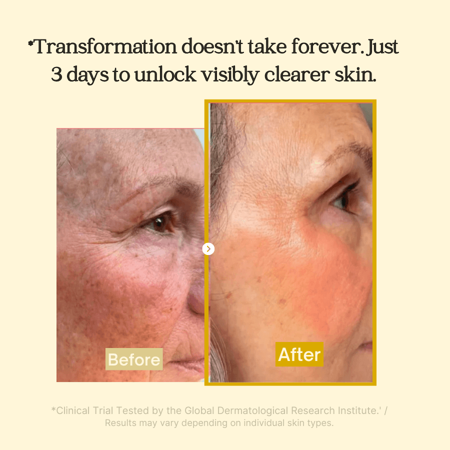 Peel-Off Face Mask for Dark Spots | Kojic Acid, Turmeric & Marine Collagen | Brightens & Evens Skin Tone Naturally