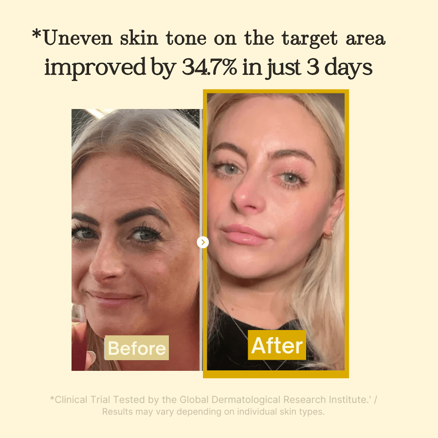 Peel-Off Face Mask for Dark Spots | Kojic Acid, Turmeric & Marine Collagen | Brightens & Evens Skin Tone Naturally