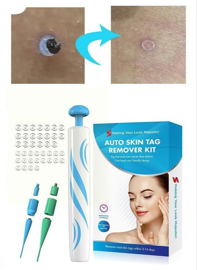Skin Tag Remover | One Hand Micro Band Ligation Kit