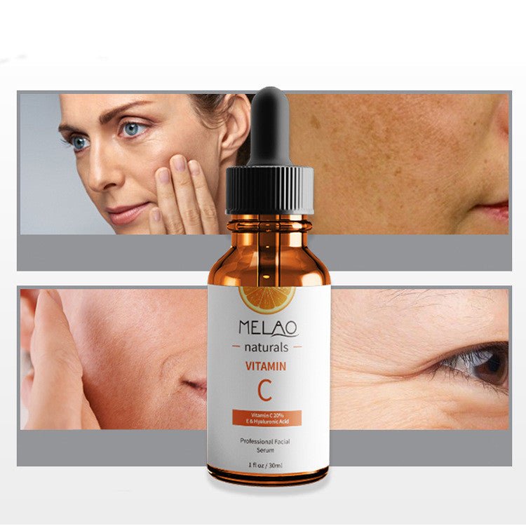 Vitamin C Anti-Wrinkle Serum for Women | 30ml with High-Penetration Vitamin C | Brightens Skin Tone & Supports Collagen