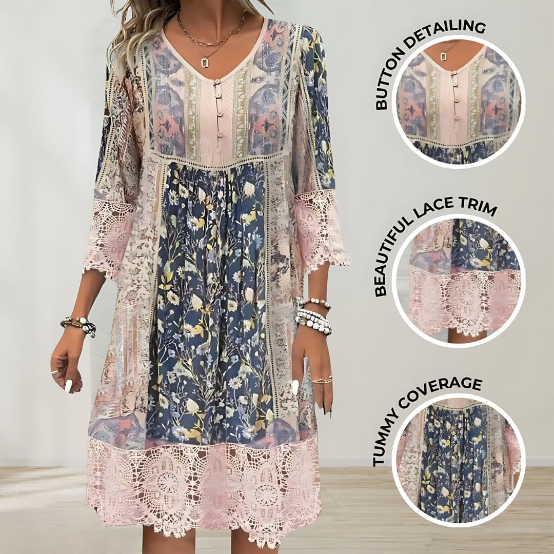 Women's Boho Midi Dress - V-Neck, Relaxed Fit Summer Style - Button Closure - Floral - Lace Accents